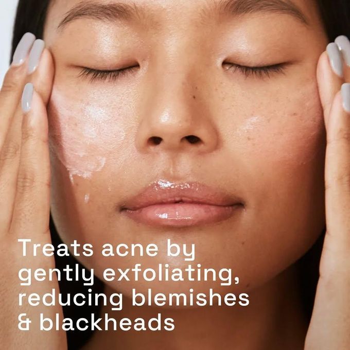 Cetaphil Gentle Clear Pore Clearing Acne Cleanser with 2% salicylic acid. Deeply cleanses, treats acne by gently exfoliating, reduce breakouts, blemishes & blackheads, improve skin tone & texture.