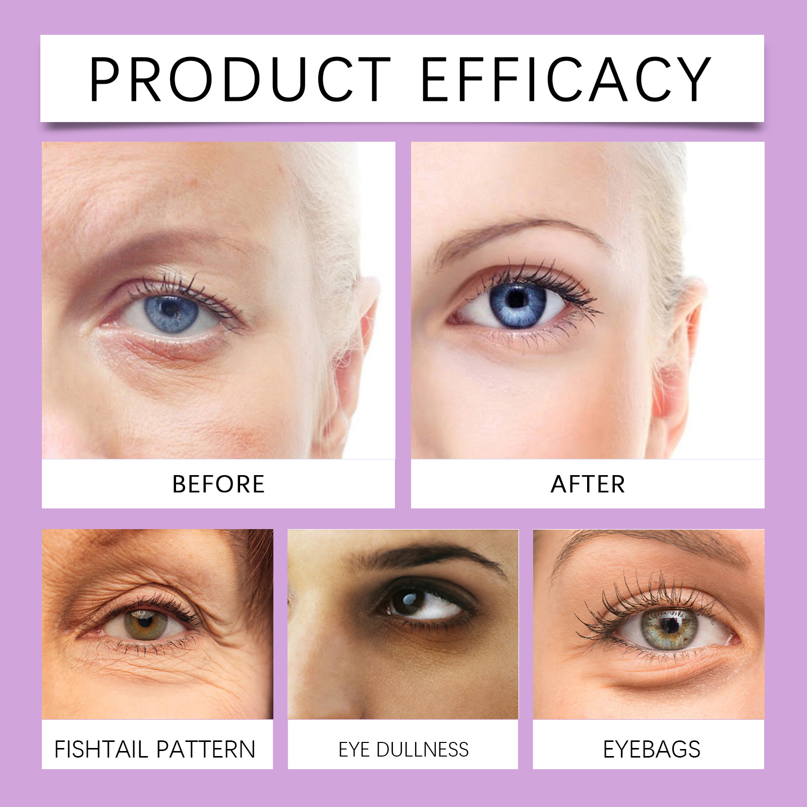 HOYGI Eye Care Cream - Gentle and Hydrating, Keeps Your Eye Area Moisturized and Nourished