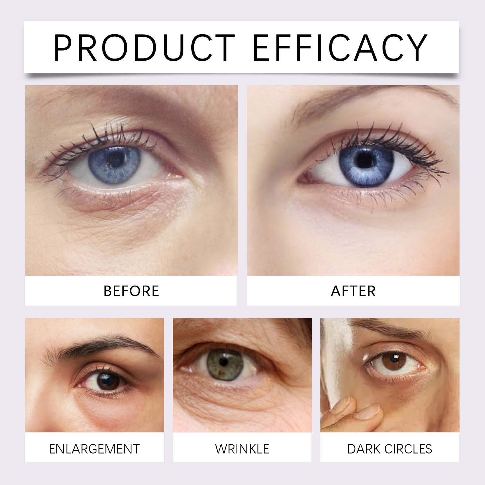 Hoygi Collagen Eye Cream - Elastic and Hydrating, Moisturizes and Cares for the Eye Area, Nourishing and Brightening Eye Cream