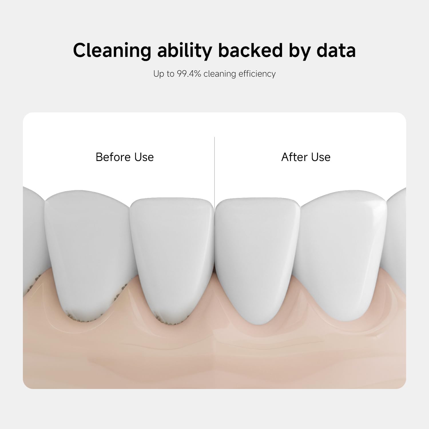 Xiaomi Water Flosser 2, Electric Oral Irrigator, Portable Dental Flosser, Rechargeable Water Jet Cleaner, Deep Teeth Cleaning Device, Gum Care Interdental Cleaner, Braces Friendly Flosser, USB-C
