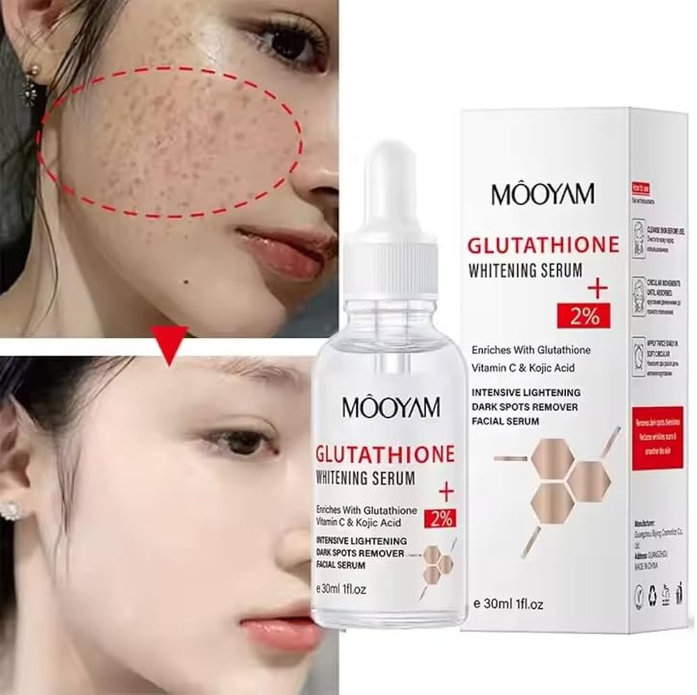 ANUA] Niacinamide 10% + TXA 4% Dark Spot Correcting Serum 30ml