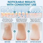 Urea 42% Cream Stick for Moisturizing, Repairing, Exfoliating, and Nourishing Cracked Skin on Hands & Feet