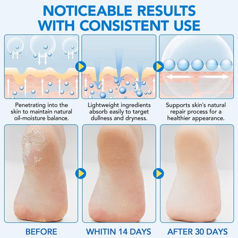Urea 60% Cream Stick for Moisturizing, Repairing, Exfoliating, and Nourishing Cracked Skin on Hands & Feet