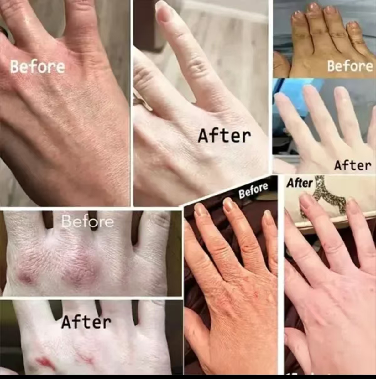 Collagen Anti Wrinkle Hand Cream, Moisturizing Repair Dry Cracked Rough Hands, Anti-Aging Whitening Nourishing Hand Lotion For African Dry Skin