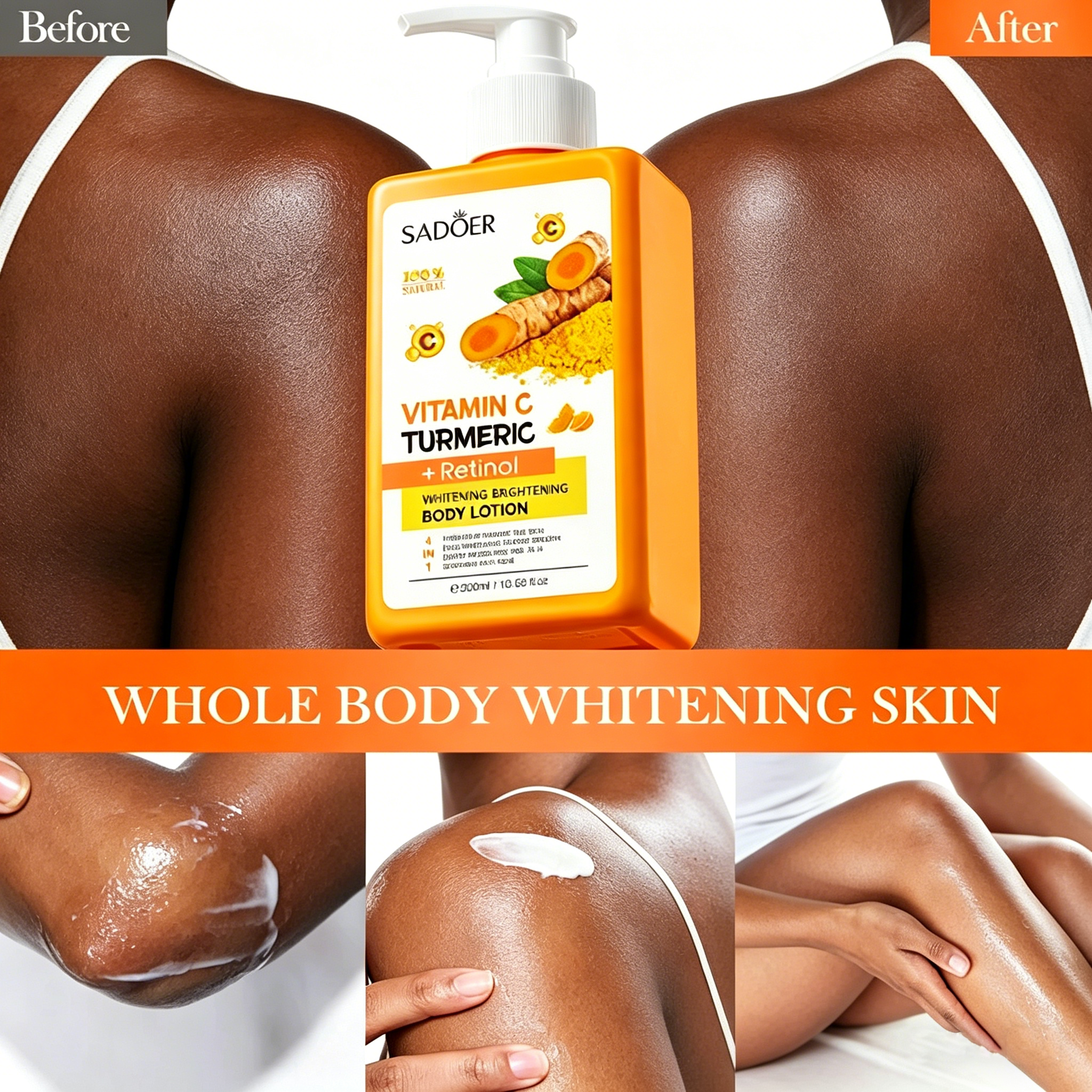 SADOER Vitamin C, Turmeric & Retinol Whitening Body Lotion - Brightens Skin Tone, Improves Dullness & Uneven Texture, Deeply Moisturizes for Soft, Smooth Glow