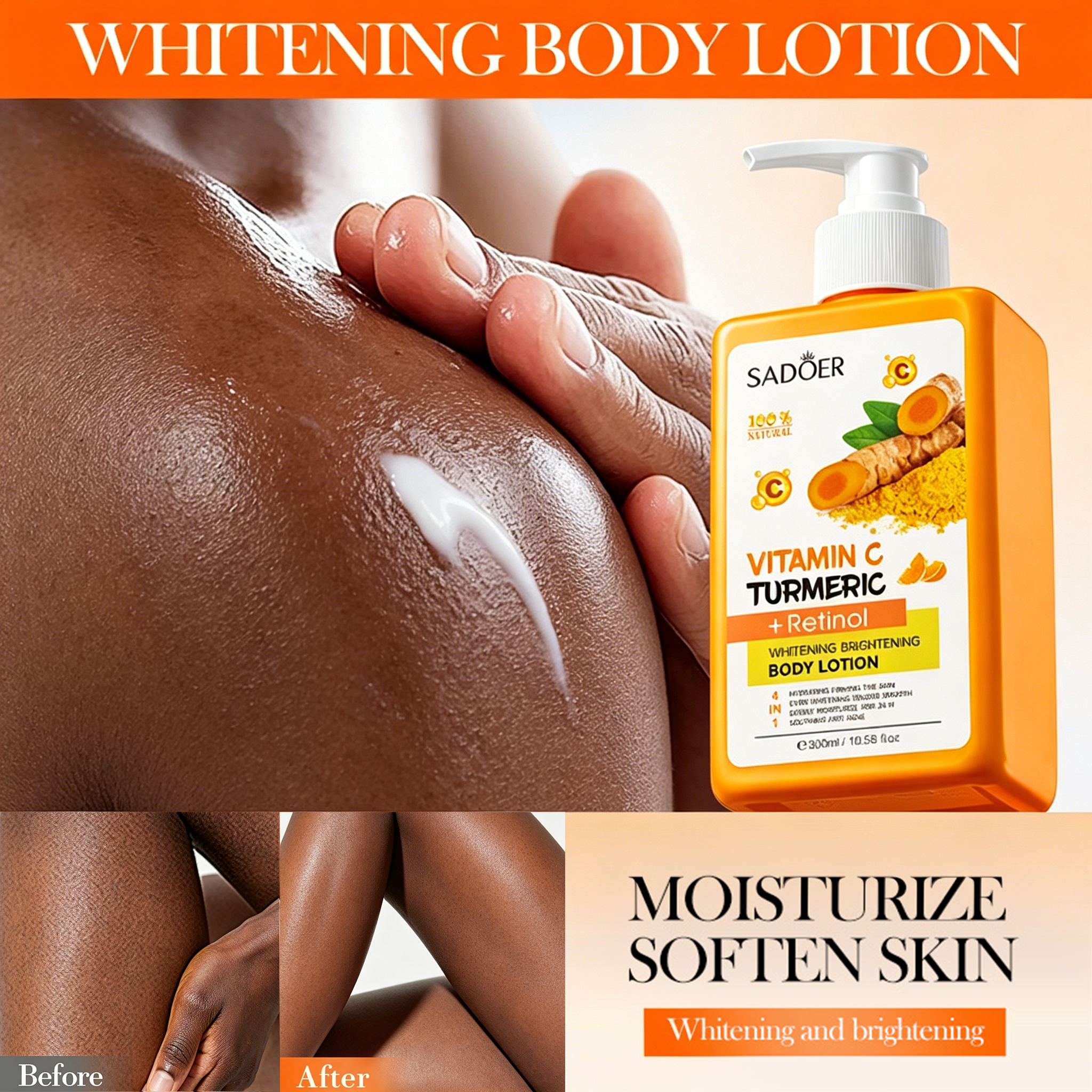 SADOER Vitamin C, Turmeric & Retinol Whitening Body Lotion - Brightens Skin Tone, Improves Dullness & Uneven Texture, Deeply Moisturizes for Soft, Smooth Glow