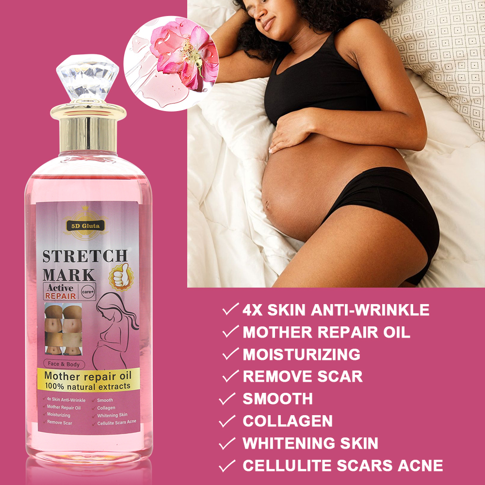 Stretch Mark Removal Oil Belly, Hands, Legs Marks Repairing Pregnancy Obesity Body Marks Removal Scar Moisturizing Repair Anti-Aging Anti-Winkles Cream Increase Skin Elasticity Smooth Firm