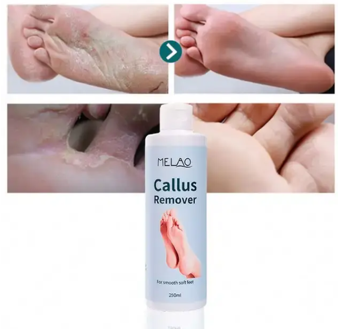 Melao Nourish Skin Foot Exfoliating Gel 250ml