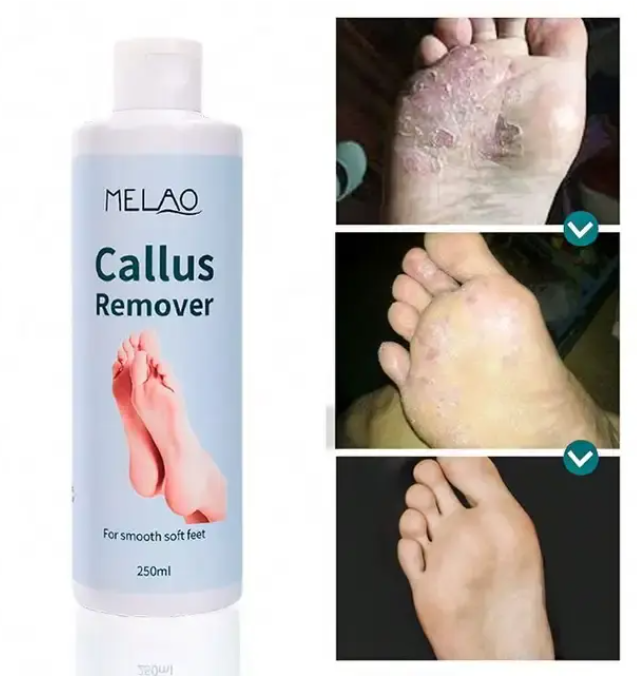 Melao Nourish Skin Foot Exfoliating Gel 250ml