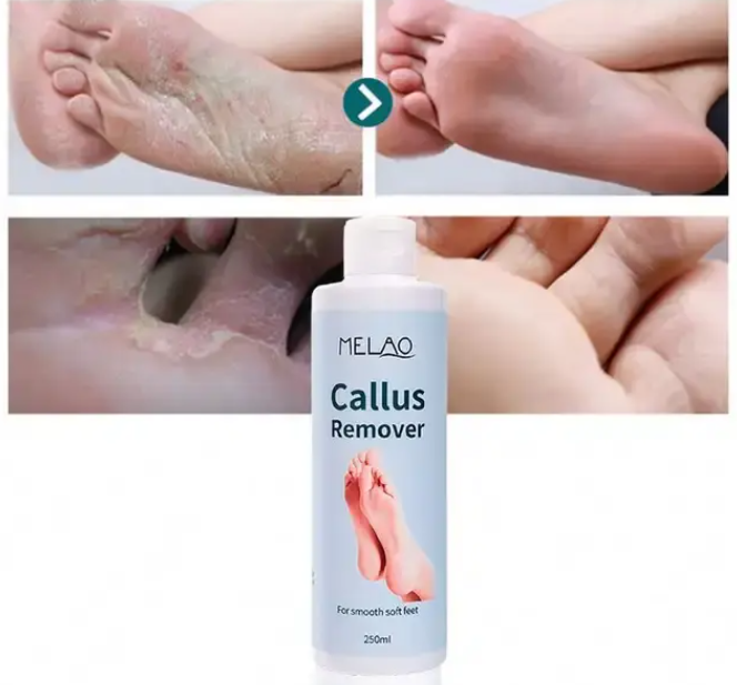 Melao Nourish Skin Foot Exfoliating Gel 250ml