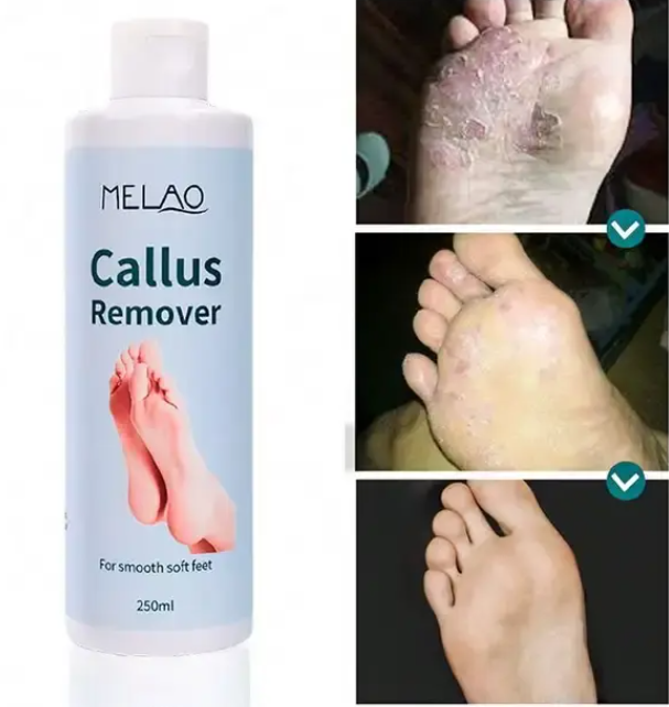 Melao Nourish Skin Foot Exfoliating Gel 250ml