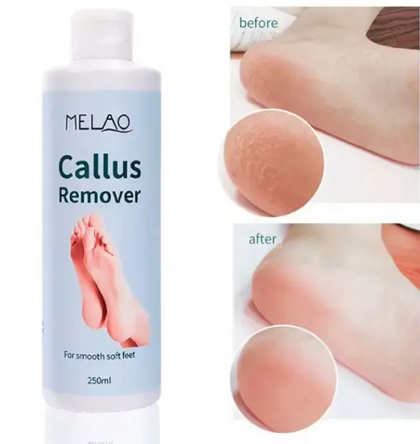 Melao Nourish Skin Foot Exfoliating Gel 250ml