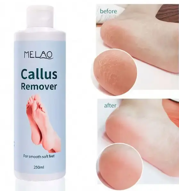 Melao Nourish Skin Foot Exfoliating Gel 250ml