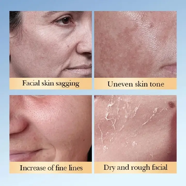 SADOER 7% Glycolic Acid + Ceramide Toner 230ml For Skin Renewal, Exfoliation, Anti-Dark Spots, Smooth Texture & Radiant Youthful Glow Brightens, And Restores Skin For A Clear, Smooth And Radiant Glow