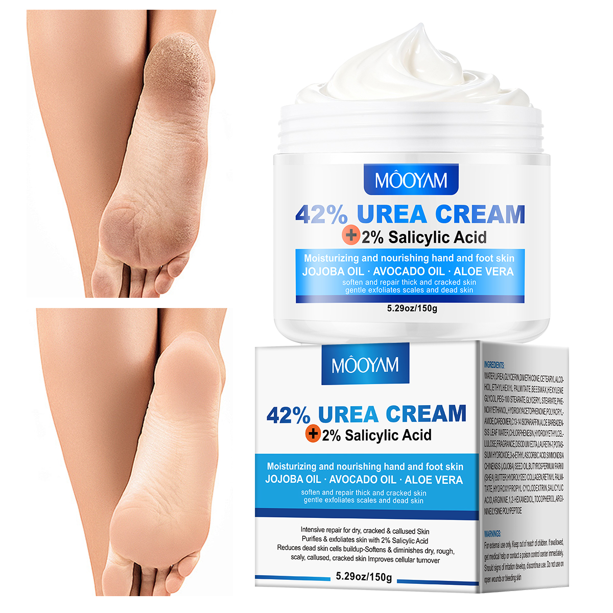 Mooyam 42% Urea Cream 2% Salicylic Acid Foot Cream Hand Lotion for Rough Dry Cracked Skin - Callus Dead Skin Remover and Moisturizer with Jojoba Oil, Avocado Oil, Aloe Vera
