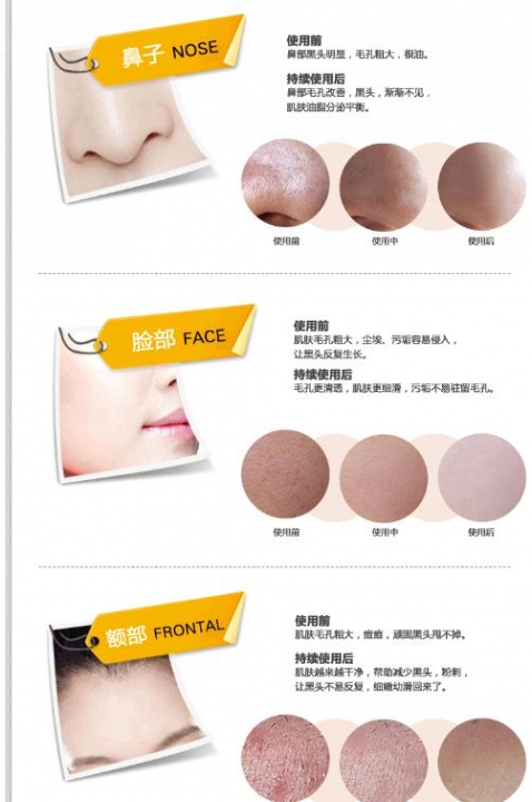 Blackhead mask oil control skin care tear film nasal membrane acne shrink pores cosmetics