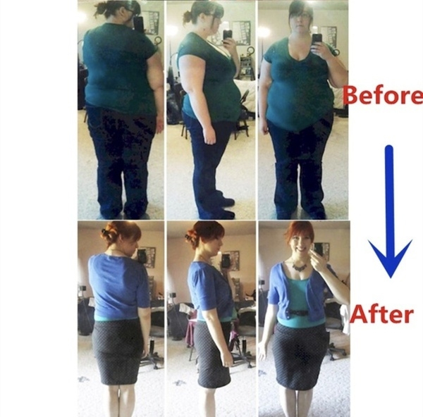 10PCS Chinese Medicine Strongest Weight Loss Navel Stick Magnetic Slim Fat  Slimming Diets Slim