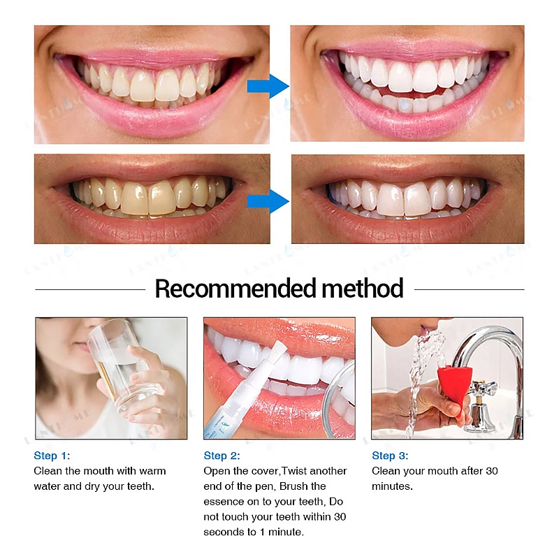 Teeth Whitening Gel Pen Oral Care Tooth Cleaning Tool Whitener Teeth Whitening Oral Hygiene Pen