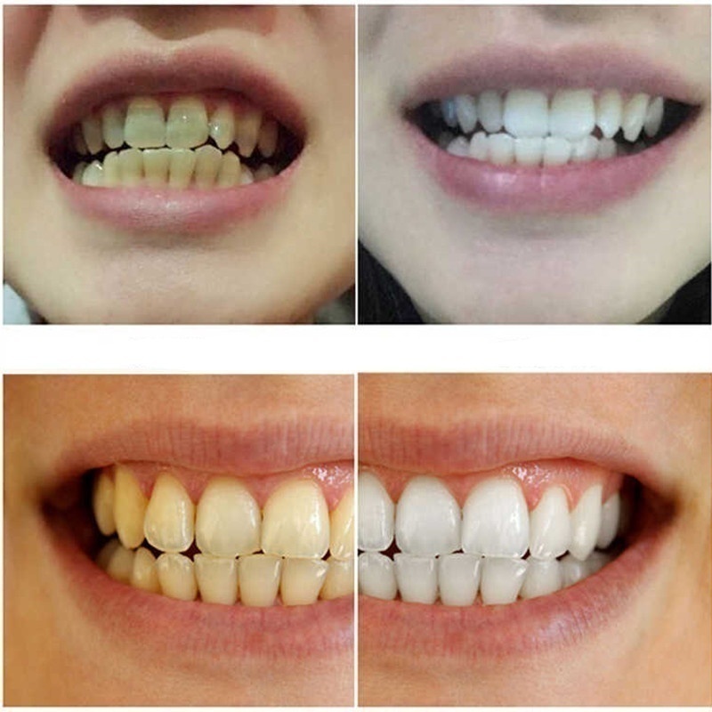 Teeth Whitening  Remove Plaque Stains Brighten Tooth Whitening Oral Hygiene Clean Serum Bleaching