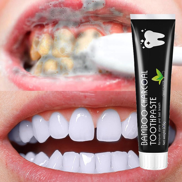 Toothpaste Teeth Whitening Refresh Breath Stain Remove White Teeth Cleaning Hygiene Oral Care Dental