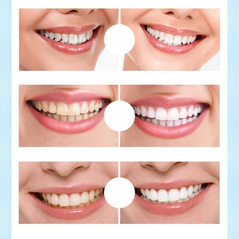 New Magic Natural Teeth Whitening Gel Pen(buy 2 Get 1 Free), 20+ Uses, Effective＆Painless