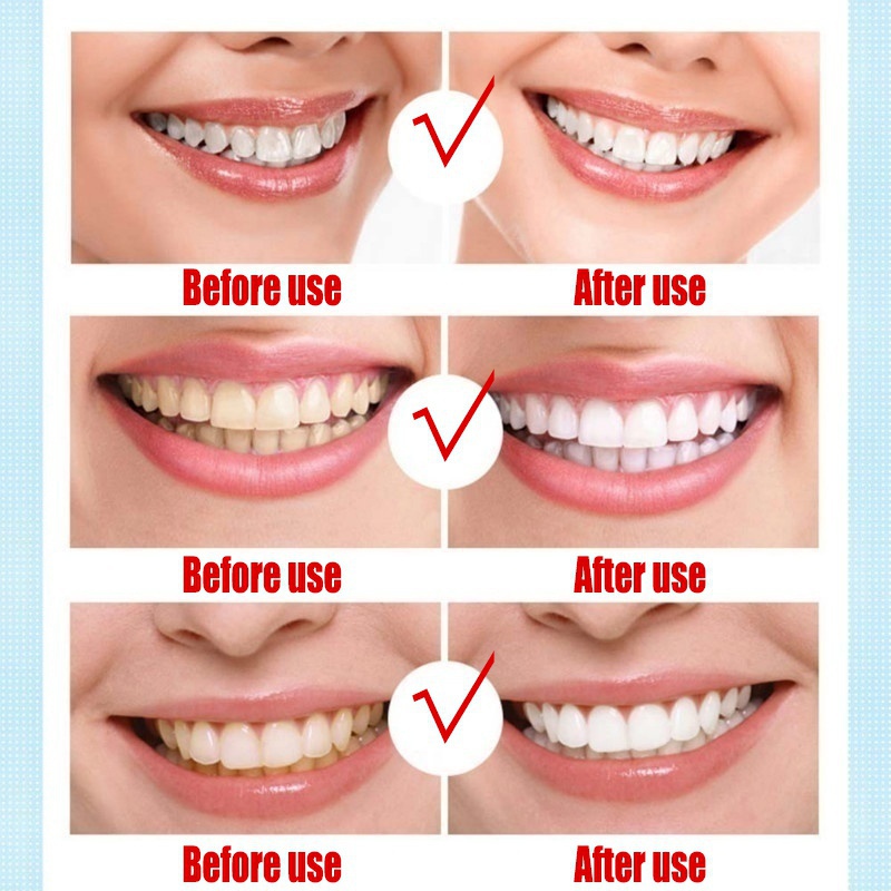 New Magic Teeth Whitening Gel Pen Oral Care Remove Stains Tooth Cleaning Teeth Whitener Tools
