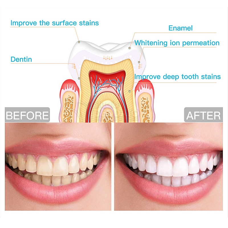 teeth whitening gel pen oral care remove stains teeth cleaning tool whitening agent teeth whitening