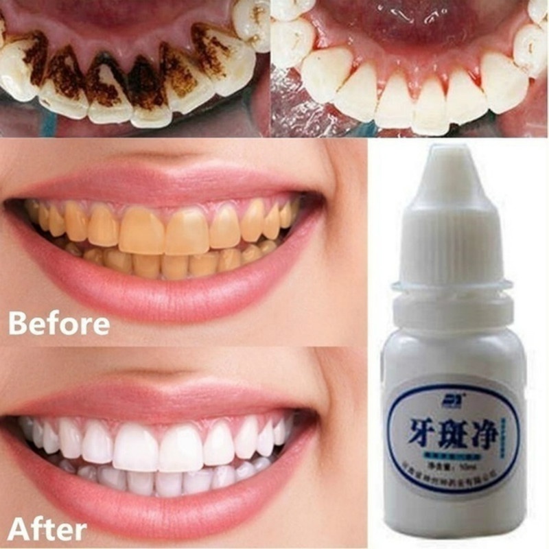 Tooth WTooth Whitening Powder Activated Coconut Charcoal Natural Teeth Whitening Charcoal Powder