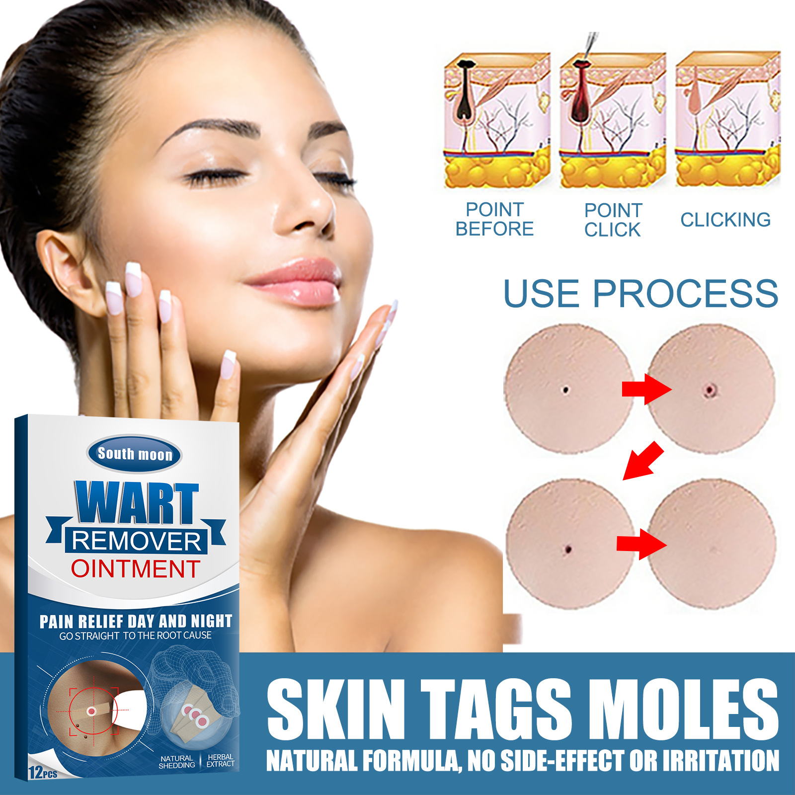New Warts Remover Ointment Wart Treatment Cream Skin Tag Remover Herbal Extract Foot Corn Antibacterial Warts Ointment Papillomas Rapidl