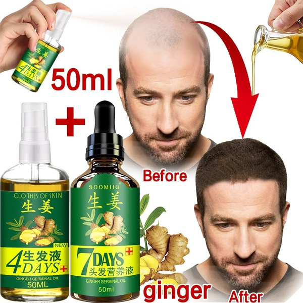 2021 Hair Growth Essence Anti-hair loss, repair damaged hair, grow faster30ml