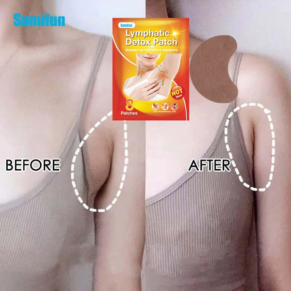 Sumifun Nutrispot Neck Lymphatic Detox Patch Chinese Herbal Lymph Pads Detox Slimming Pads To Improve Sleep