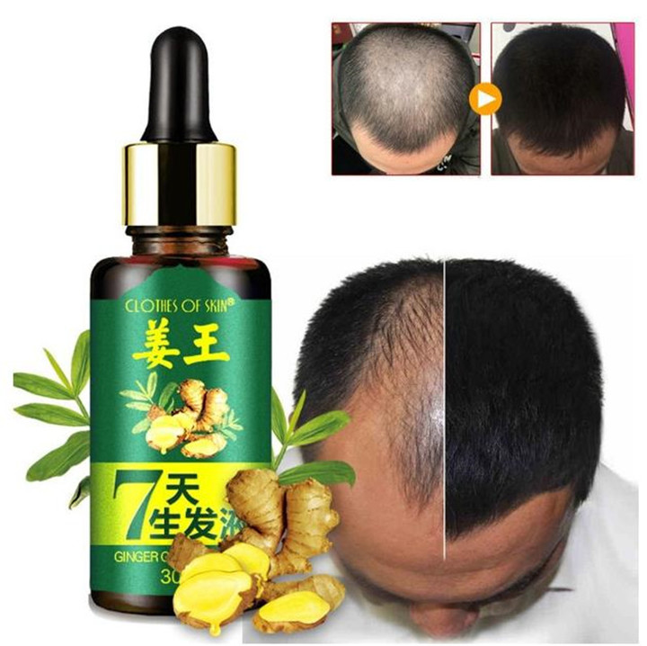 Hair Growth Essence liquid Fast Hair Growth Natural Hair Loss Treatment