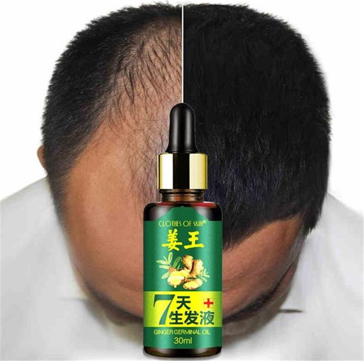 Hair Growth Essence liquid Fast Hair Growth Natural Hair Loss Treatment