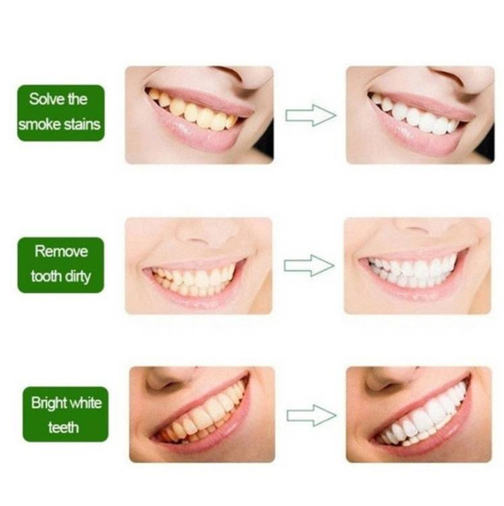 Magic Natural Teeth Whitening Oral Hygiene Cleaning Oral Teeth Care