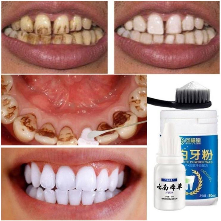 Magic Natural Teeth Whitening Oral Hygiene Cleaning Oral Teeth Care