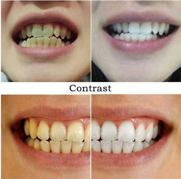 Magic Natural Teeth Whitening Oral Hygiene Cleaning Oral Teeth Care