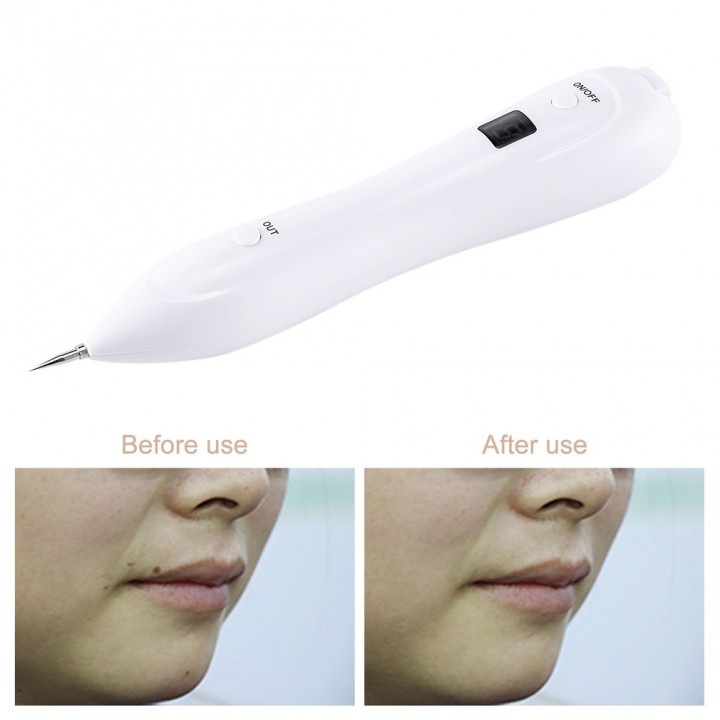 Skin Care Dark Spot Removal Pen Freckle Wart Nevus Tattoo Dot Mole Remover