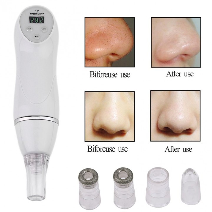 Diamond Dermabrasion Microdermabrasion Vacuum Peeling Skin Care Machine