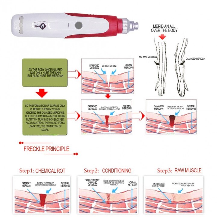 Derma Stramp Electric Pen for Anti-Wrinkle Acne-treatment Essence-absorbing