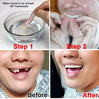 Comfortable Whitening Teeth Fake Tooth Denture Silicone Smile Veneers Beauty Tool False Tooth Oral
