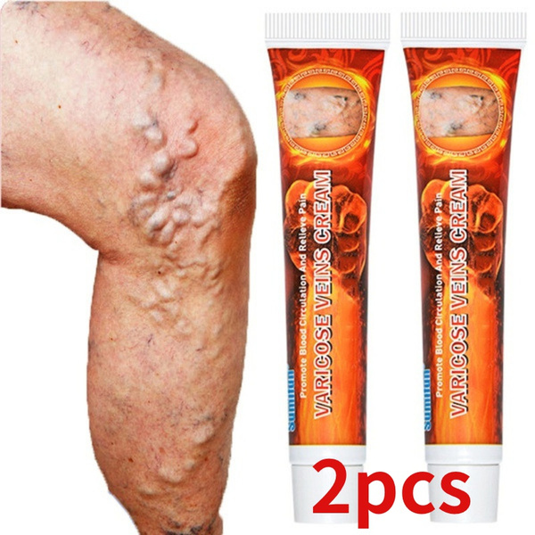 2pcs NEW 20g Varicose Veins Phlebitis Spider Cream  Removal Herbal Medical Plaster Arrow
