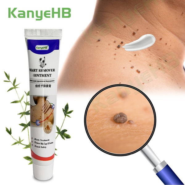 1 Piece of Wart Removal Cream Skin Tag Removal Mole Remover Anti-wart Treatment for Genital Warts Treatment for Papilloma