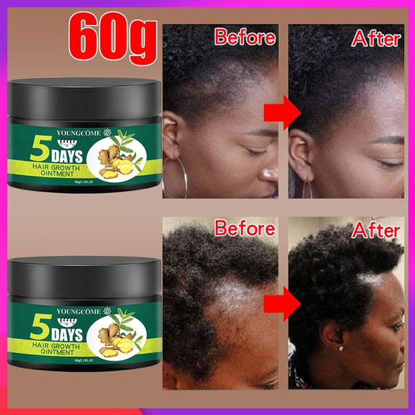 Newest Hair Growth Hair Care Ointment Natural Hair Loss Treatment for Hair Grows Fast Hair Repair Health Care Beauty Dense Hair Growth Ointm