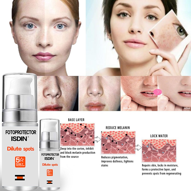 The latest vitamins, whitening cream, repair and fade freckles, remove dark spots, melanin remover