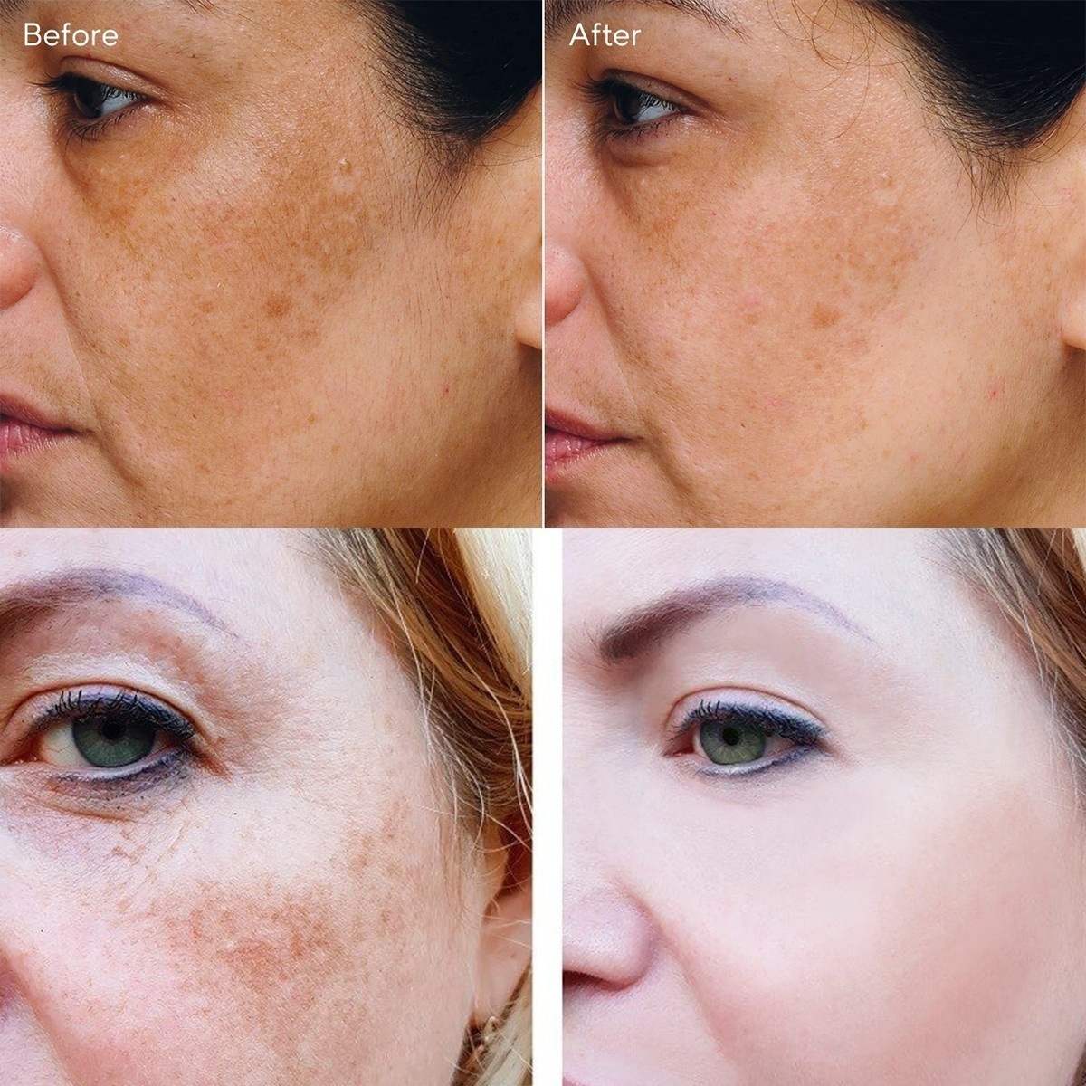 The latest vitamins, whitening cream, repair and fade freckles, remove dark spots, melanin remover