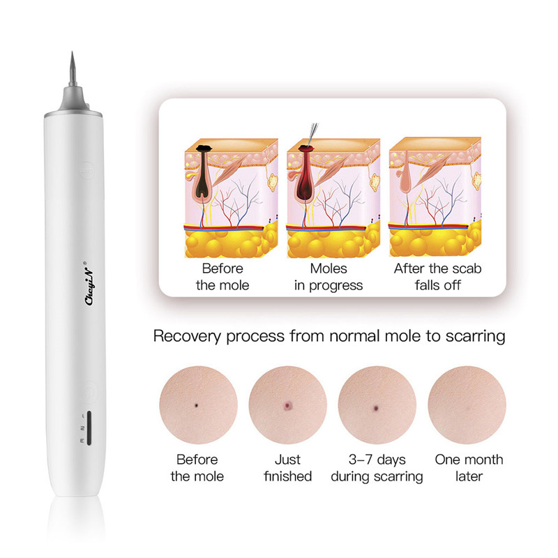 Rechargeable Mole Removal Pen Home Blue Light Dark Spot Remove Device