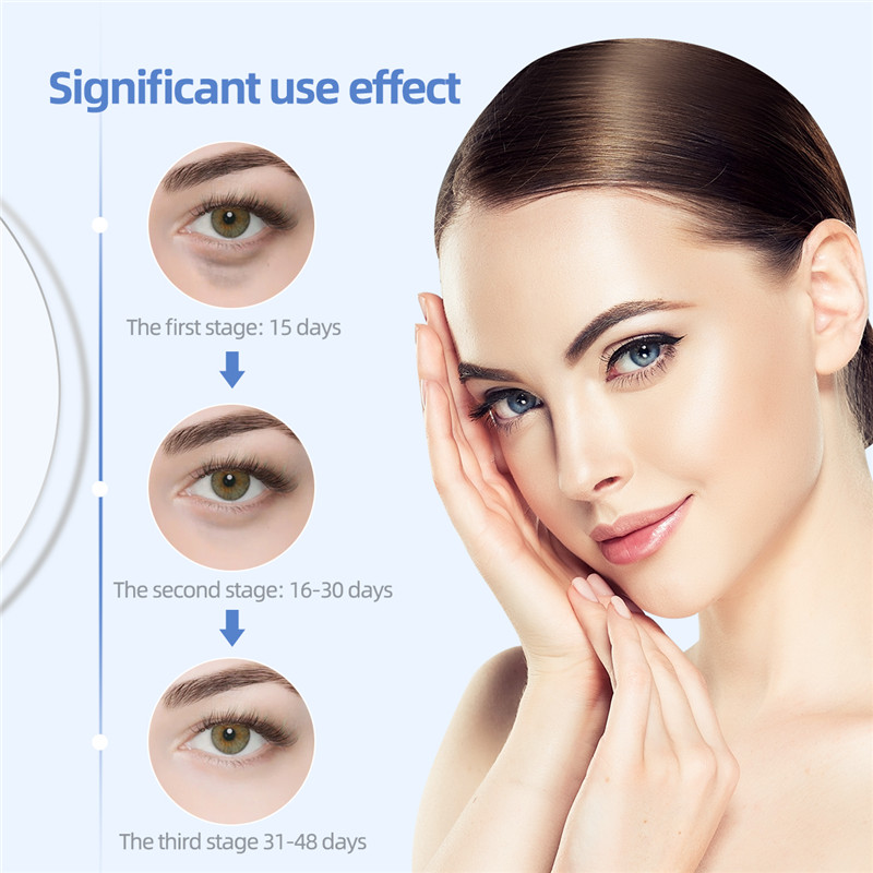 Eye Massager Electric Vibration Ion Warm Massage Remove Wrinkles Dark Circles Eye Bags Anti Aging Beauty Device Skin Care view 6