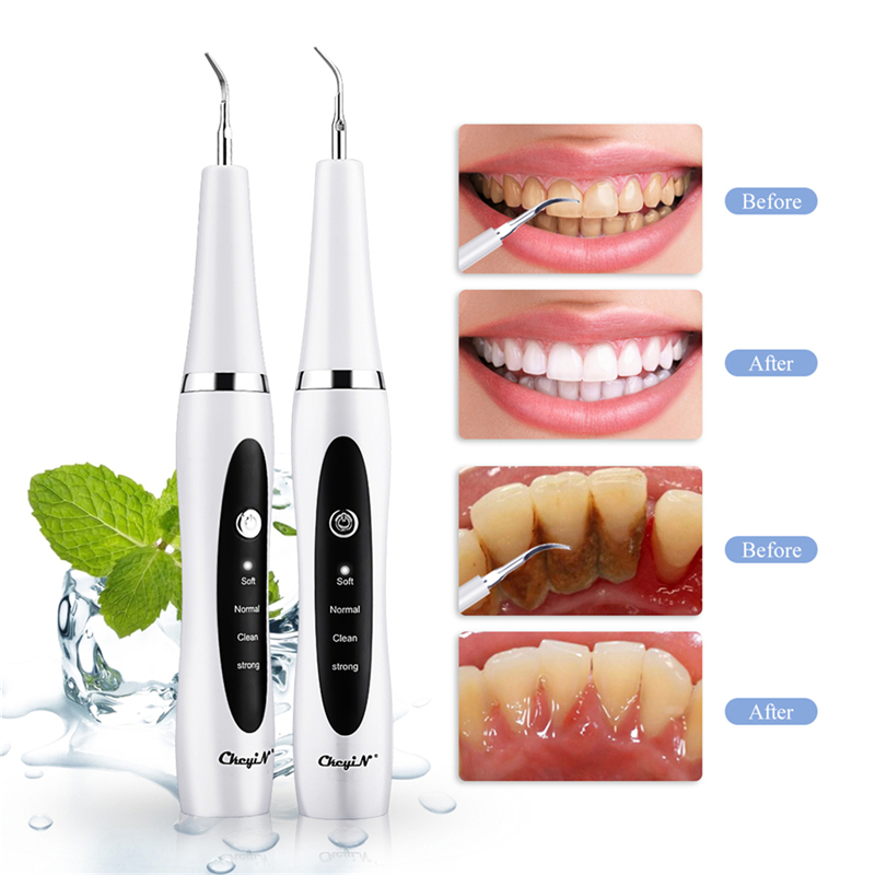 Electric Sonic Dental Scaler Teeth Whitening Tartar Teeth Cleaning Tool Portable Calculus Remover