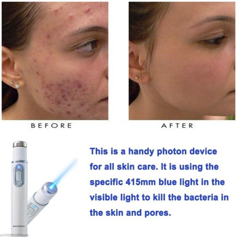 Acne Wrinkle Removal Laser Pen Skin Spots Removal Anti Varicose Veins Spider Vein Gum Treatment Portable Medical Blue Light Therapy