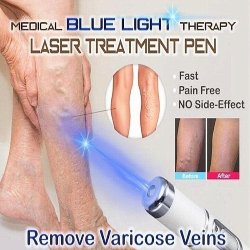 Acne Wrinkle Removal Laser Pen Skin Spots Removal Anti Varicose Veins Spider Vein Gum Treatment Portable Medical Blue Light Therapy